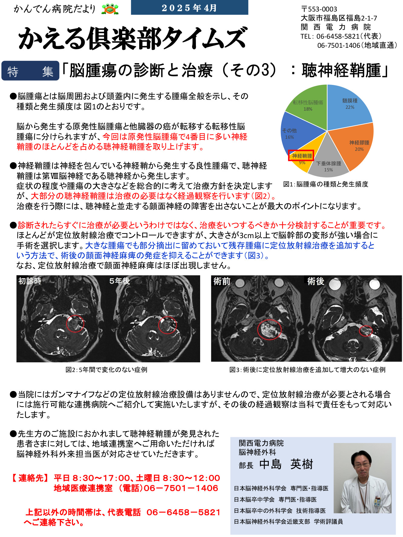 脳腫瘍の診断と治療（その２）：神経膠腫