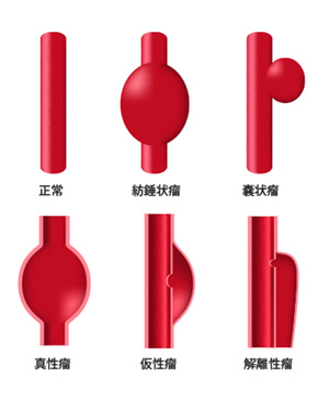 形態別・病因別分類の画像