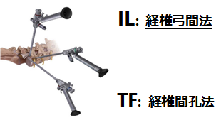 FED手術のアプローチ画像