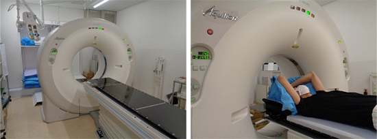 キヤノンメディカルシステムズ社製 治療計画用CT装置 Aquilion LB写真